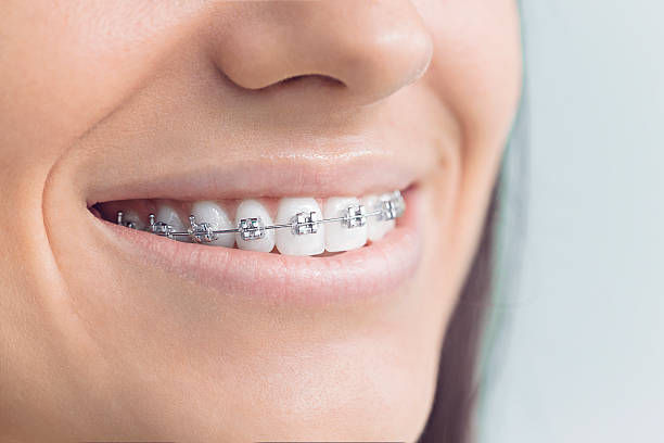 Best Dental Exams and Cleanings  in Portola Valley, CA